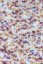 MOSAIC - BORDEAUX/LILA/PINK/GELB